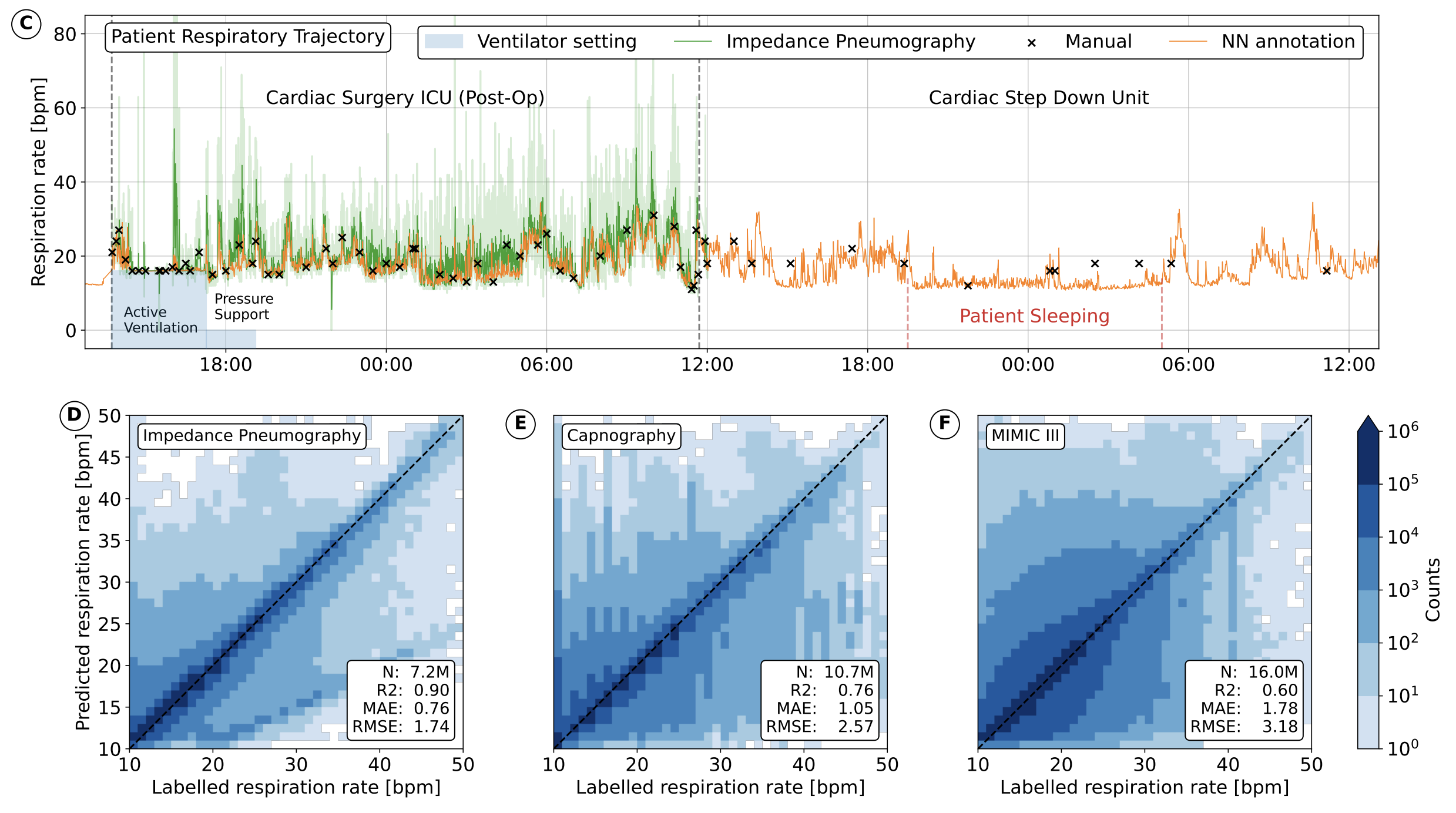 Deep learning models can predict respiration rate from raw telemetry ECG signals, unlocking novel clinical applications